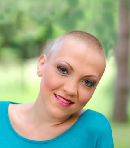 OUR EXPERTISE IN ALOPECIA CARE