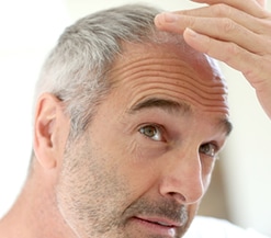 hair thinning, cancer care expert