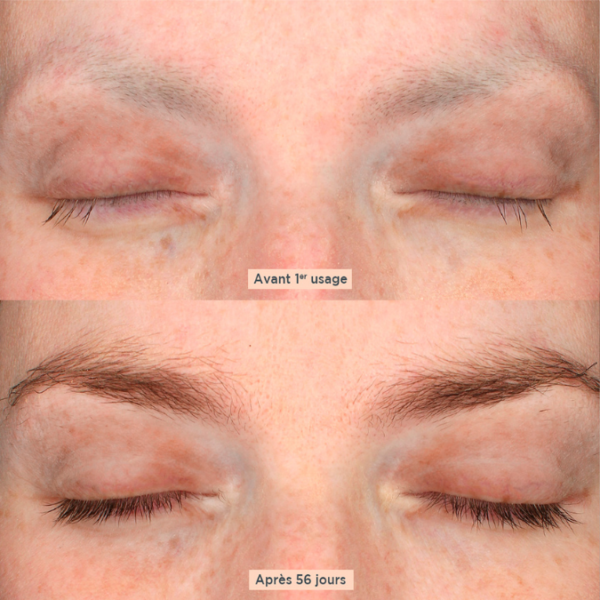 Meme Eyebrow & Eyelash Booster Serum for Regrowth before and after