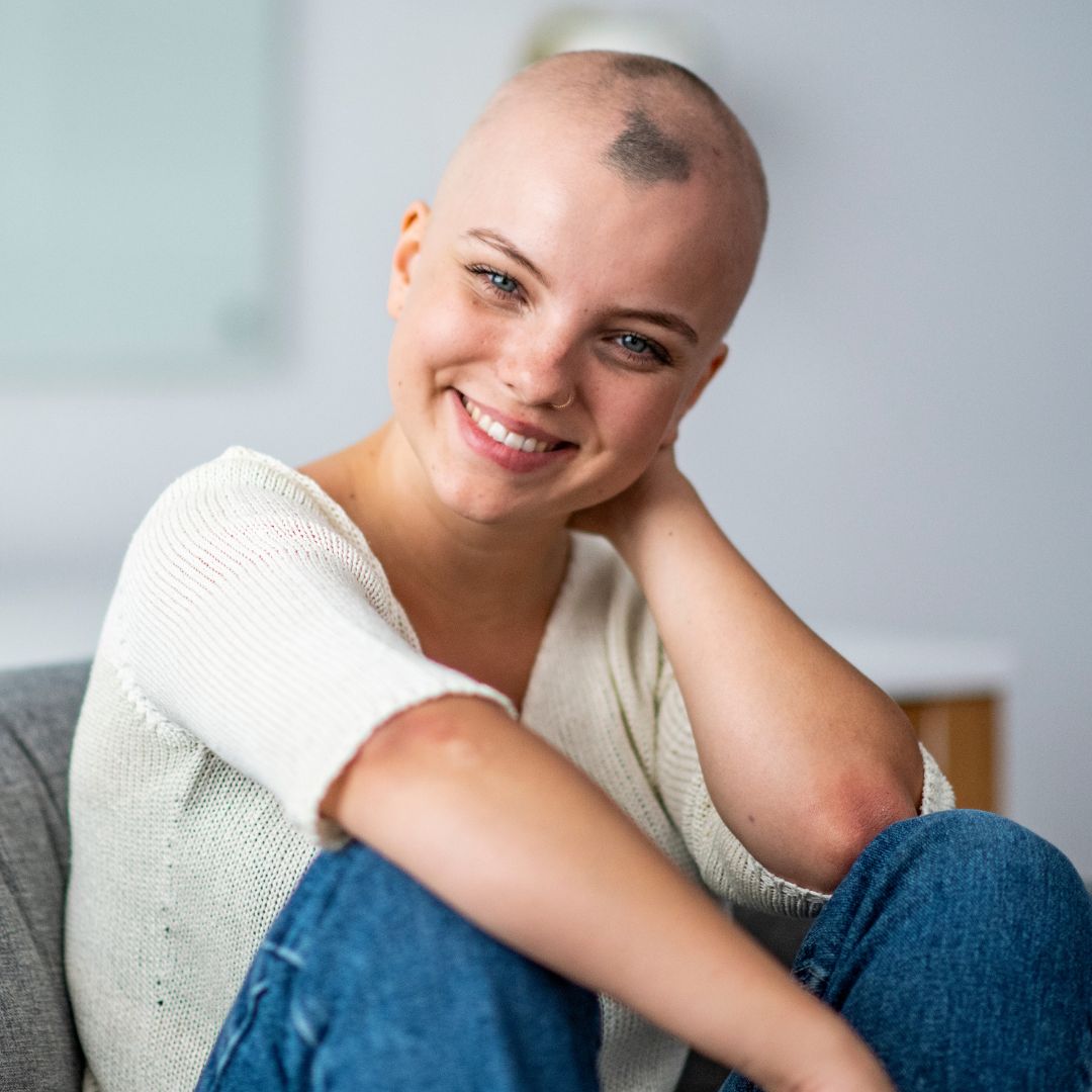 A lady who has alopecia smiling for the camera