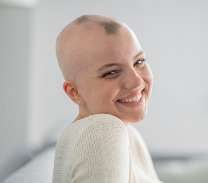 alopecia clients home
